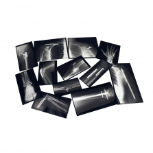 Roylco Fixed Bones X-Ray Set